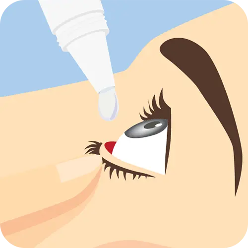 Close-up of the eye on a face; eye drop is about to drop into the pocket of the eye formed by the finger pulling back on the bottom eyelid.